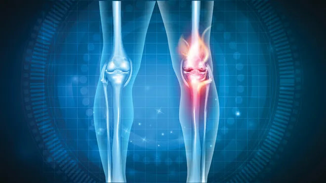 Rebounders contribute to joint health